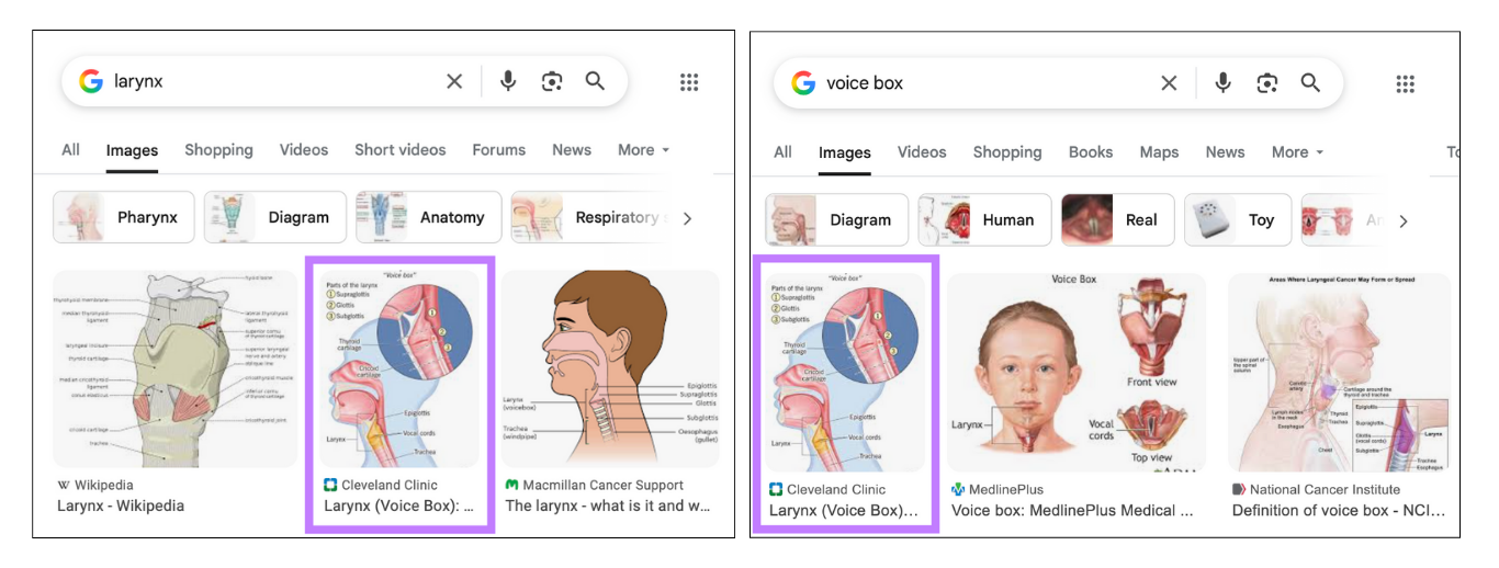 Image appears for both larynx and voice box search results.